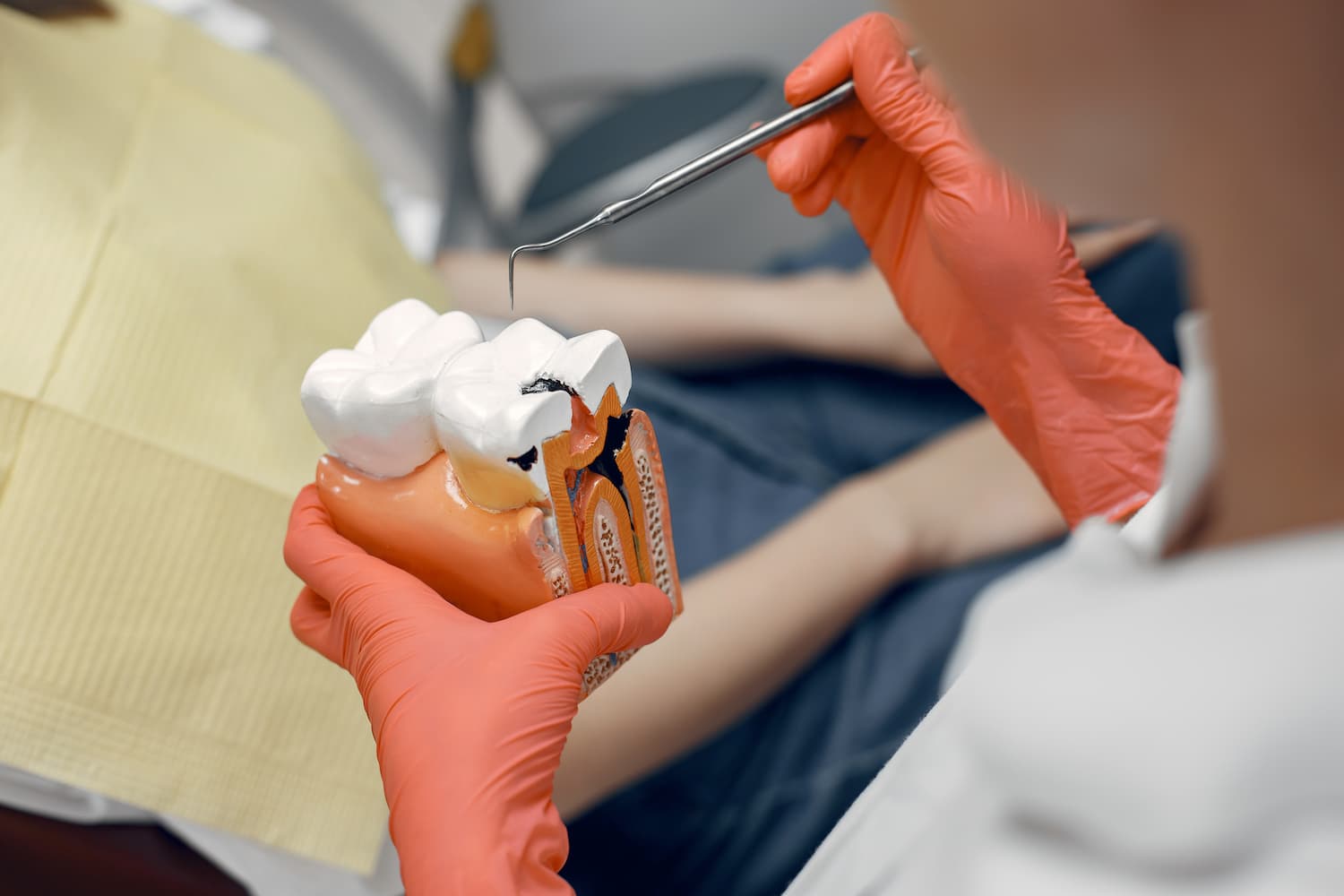 Endodontia - Clínica Odontológica Tornelli