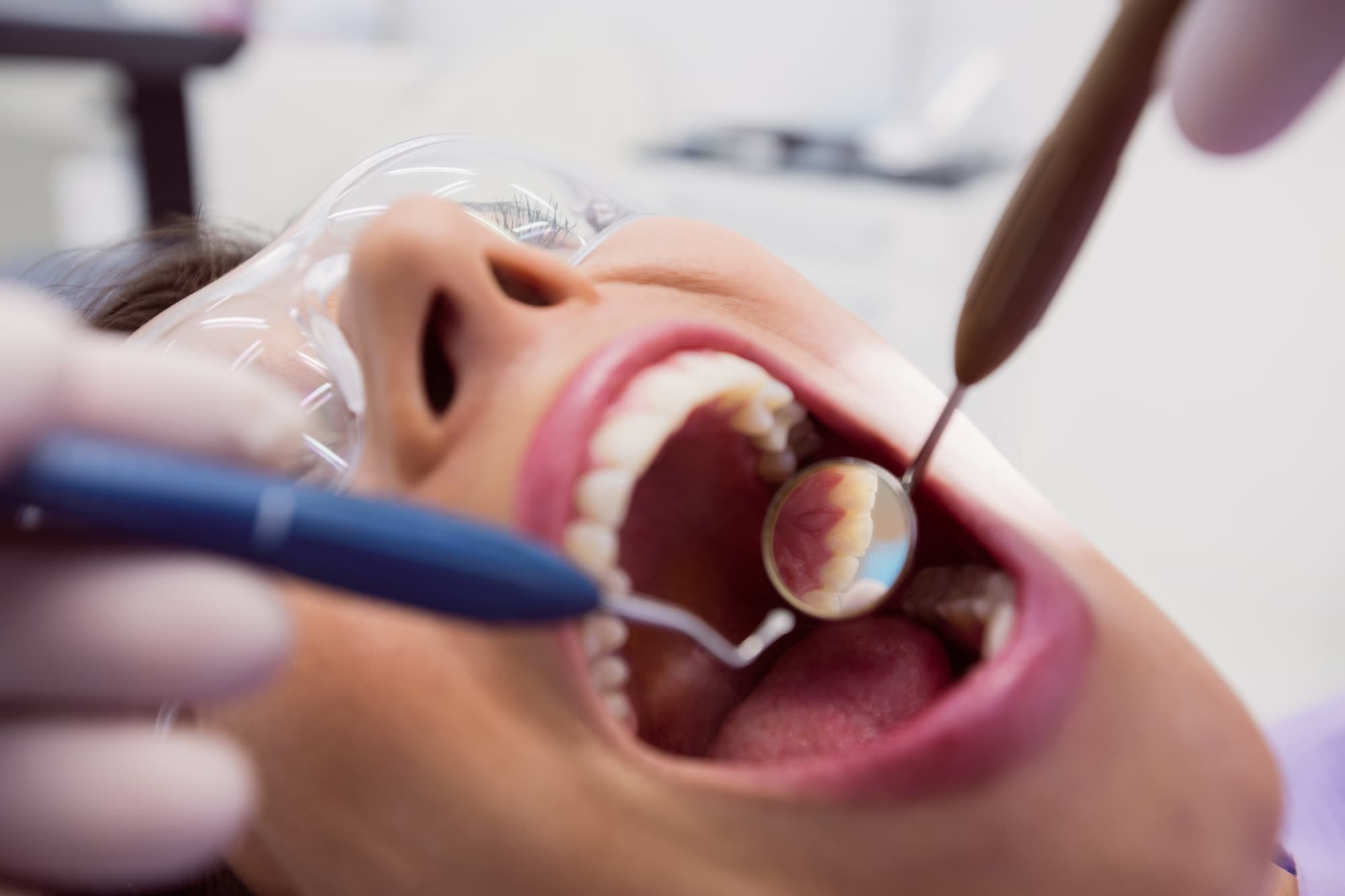 Periodontia - Clínica Odontológica Tornelli